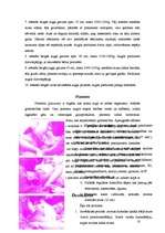 Referāts 'Grūtniecība', 18.