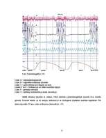 Referāts 'Fizioloģiskais miegs', 17.