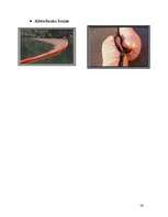 Referāts 'Baltijas jūras piesārņošana ar naftas produktiem un tās likvidācijas paņēmieni', 36.