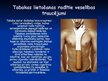 Prezentācija 'Tabakas ietekme uz cilvēka organismu', 5.