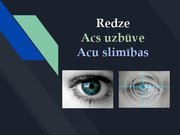 Prezentācija 'Redze. Acs uzbūve. Acu slimības', 1.