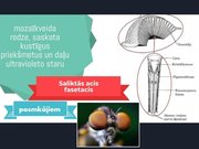 Prezentācija 'Redze. Acs uzbūve. Acu slimības', 9.