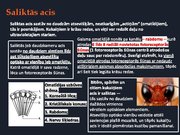 Prezentācija 'Redze. Acs uzbūve. Acu slimības', 15.