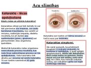 Prezentācija 'Redze. Acs uzbūve. Acu slimības', 34.