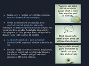 Prezentācija 'Redze. Acs uzbūve. Acu slimības', 41.