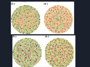 Prezentācija 'Redze. Acs uzbūve. Acu slimības', 49.