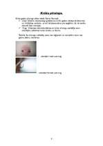 Referāts 'Pīrsings, tetovējumi, permanentais meikaps', 6.