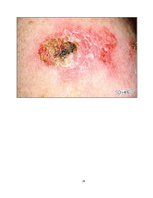 Referāts 'UV staru ietekme uz cilvēka ādu un organismu', 24.