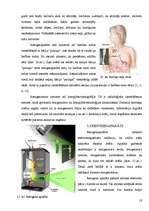 Referāts 'Radiācija un tās izmantojums medicīnā', 16.