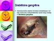 Prezentācija 'Nekroze un gangrēna', 11.
