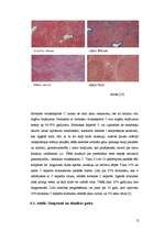 Referāts 'Vīrusa hepatīti', 15.