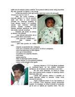 Konspekts 'Hromosomu aberācijas, monogēnās un multifaktoriālās slimības', 10.