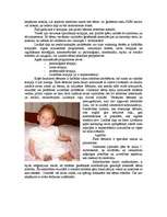 Konspekts 'Hromosomu aberācijas, monogēnās un multifaktoriālās slimības', 11.