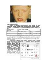 Konspekts 'Hromosomu aberācijas, monogēnās un multifaktoriālās slimības', 17.