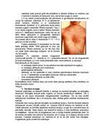 Konspekts 'Hromosomu aberācijas, monogēnās un multifaktoriālās slimības', 20.