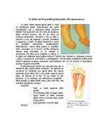 Konspekts 'Hromosomu aberācijas, monogēnās un multifaktoriālās slimības', 23.