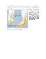 Konspekts 'Hromosomu aberācijas, monogēnās un multifaktoriālās slimības', 24.