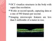 Prezentācija 'Optical Coherence Tomography', 6.