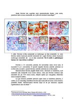 Konspekts 'Fizioloģiskie hemoglobinogēnie pigmenti', 9.