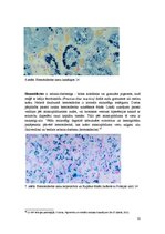 Konspekts 'Fizioloģiskie hemoglobinogēnie pigmenti', 11.