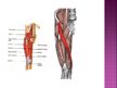Prezentācija 'Apakšējās ekstremitātes muskuļi', 26.