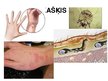 Prezentācija 'Ādas un slimības', 7.