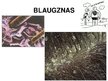 Prezentācija 'Ādas un slimības', 11.