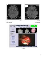 Referāts 'Neiroķirurģijas attīstības vēsture Paula Stradiņa klīniskās universitātes slimnī', 9.