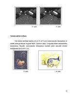 Referāts 'Neiroķirurģijas attīstības vēsture Paula Stradiņa klīniskās universitātes slimnī', 20.