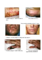 Referāts 'Apdegumi', 18.