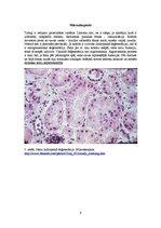 Konspekts 'Nieru hidropiskā deģenerācija', 9.