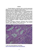 Konspekts 'Nieru hidropiskā deģenerācija', 10.