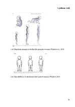 Referāts 'Sākumskolas vecuma bērnu stāja un tās traucējumi', 34.