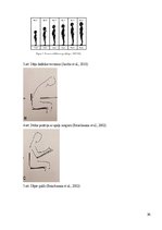 Referāts 'Sākumskolas vecuma bērnu stāja un tās traucējumi', 35.