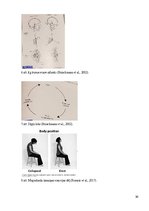 Referāts 'Sākumskolas vecuma bērnu stāja un tās traucējumi', 36.