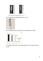 Referāts 'Sākumskolas vecuma bērnu stāja un tās traucējumi', 37.