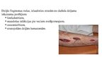 Prezentācija 'Flegmona', 13.