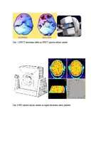 Referāts 'PET un SPECT tomogrāfiskās pētīšanas metodes', 6.