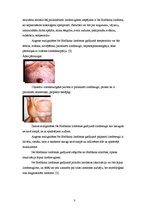 Referāts 'Ne Hodžkina limfoma', 3.