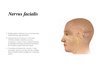 Prezentācija 'Nervus facialis parēze', 2.