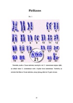 Referāts 'Latvijas sabiedrības attieksme pret bērniem ar īpašām vajadzībām. Dauna sindroms', 20.