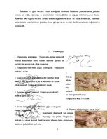 Referāts 'Fizioterapija pie displāzijas, torticollis, greizās pēdas', 6.