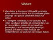 Prezentācija 'Rentgenstari', 3.
