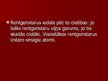 Prezentācija 'Rentgenstari', 10.