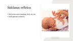Prezentācija 'Jaundzimušā refleksi', 7.