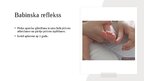 Prezentācija 'Jaundzimušā refleksi', 8.