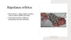 Prezentācija 'Jaundzimušā refleksi', 9.