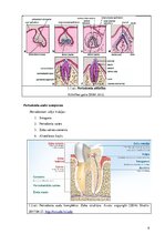 Diplomdarbs 'Periodonta slimību diagnostika un ārstēšanas metodes', 8.