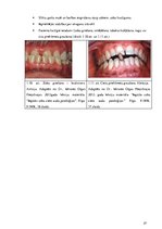 Diplomdarbs 'Periodonta slimību diagnostika un ārstēšanas metodes', 27.