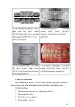 Diplomdarbs 'Periodonta slimību diagnostika un ārstēšanas metodes', 29.